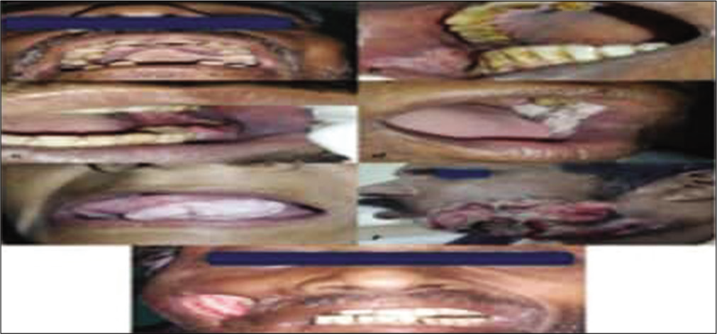 Clinical photographs showing different growth patterns in oral cavity.