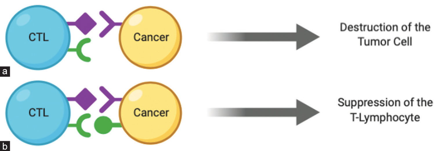 The mechanism of programmed death ligand-1 (PD-L1) immune suppression. (a) The purple wedges represent tumor neoantigens, which activate T-cell receptors (purple triangles) on cytotoxic T lymphocytes (CTL) and result in the destruction of the tumor cell by the T-cell. (b) PD-L1 on the cancer cell (green circle) binds to PD-1 on the CTL (green crescent) to evade destruction.