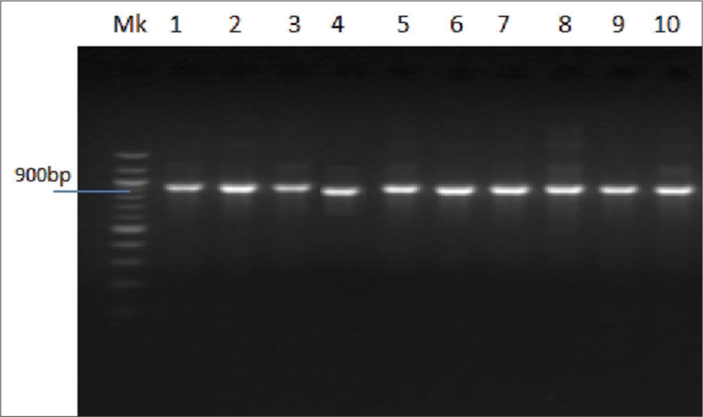 Agarose gel showing the positive amplification of p53 (tumor suppressor) gene amplified from DNA isolated from five patients using p53 gene-specific primers.